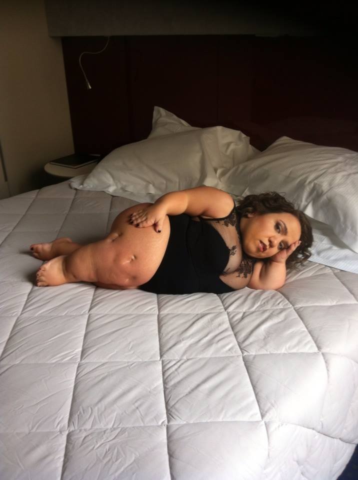 scatto boudoir disability